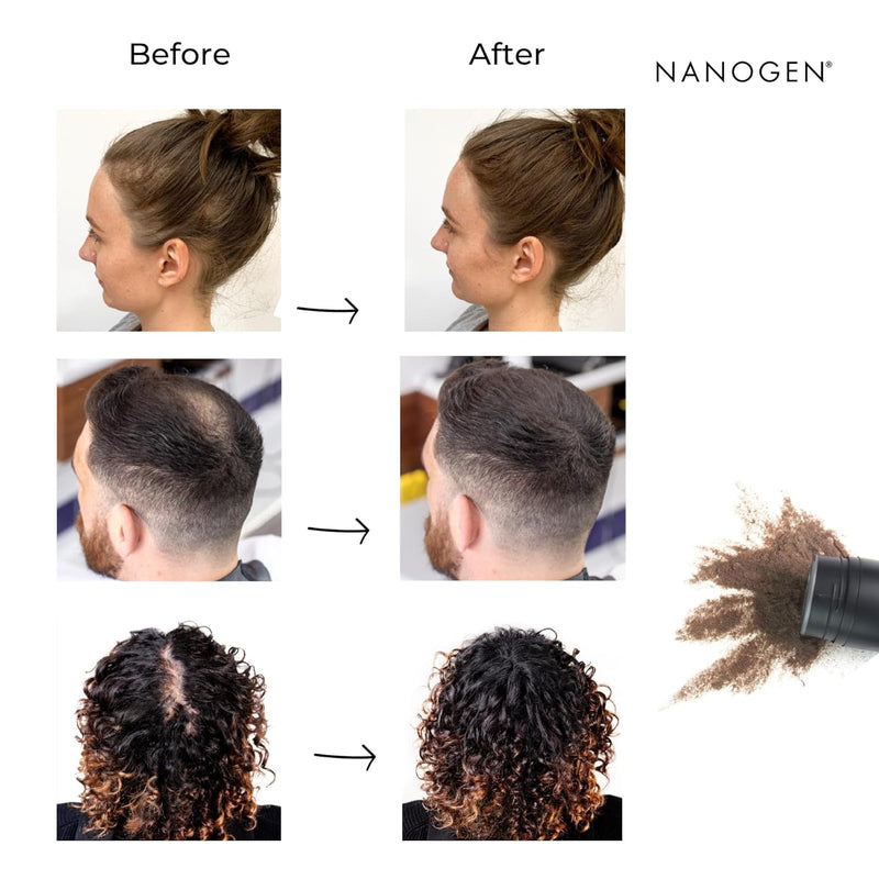 Nanogen Keratin Hair Fibres 30 Grams Shade No. 04 (Dark Brown)